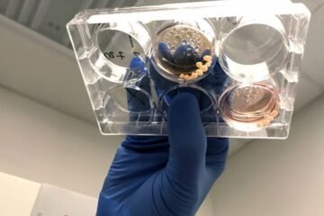 La exposición al plomo afecta a la humanidad desde hace 2 millones de años y moldeó el cerebro