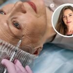 Una dermatóloga explica el tratamiento que emplea para rellenar las arrugas provocadas por la expresión facial