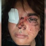 Detenidas cinco mujeres por la agresión tránsfoba ocurrida en un pueblo de León