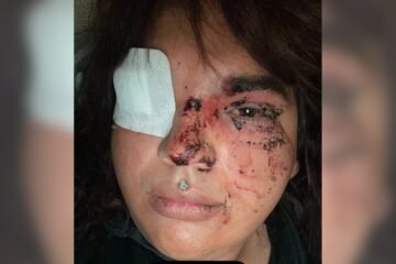 Detenidas cinco mujeres por la agresión tránsfoba ocurrida en un pueblo de León