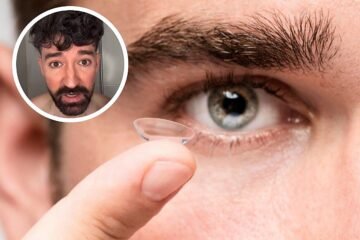 David Callejo, médico: «Nunca te duches con las lentillas puestas. El agua puede llevar un bicho que te puede dejar ciego»