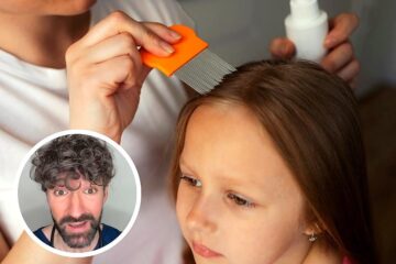 David Callejo, médico: «Los piojos no saltan ni vuelan, pasan de cabeza a cabeza por proximidad y usan los pelos largos como lianas»
