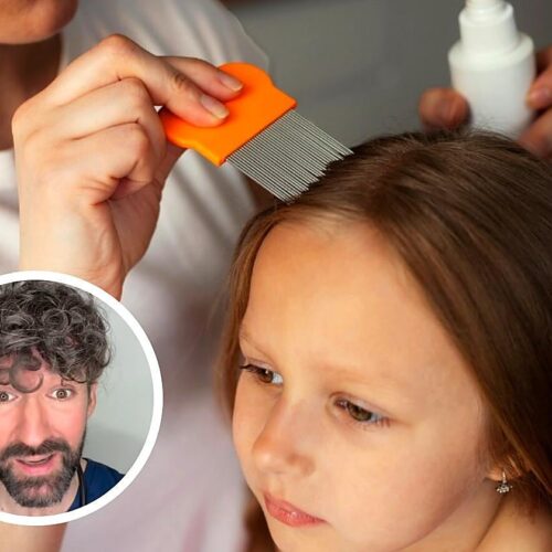 David Callejo, médico: «Los piojos no saltan ni vuelan, pasan de cabeza a cabeza por proximidad y usan los pelos largos como lianas»